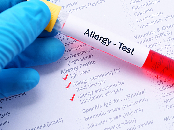 Toxicology & Allergy