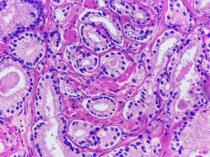 Histopathology Medilabs